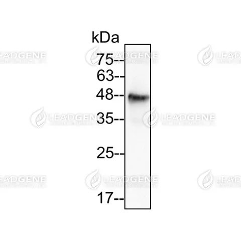 Western blotting analysis of Anti-ST2L Antibody [Clone 9G15] HT29 lysate (50 μg) was stained with mouse anti-IL-ST2L monoclonal antibody at 1:2000 dilution.