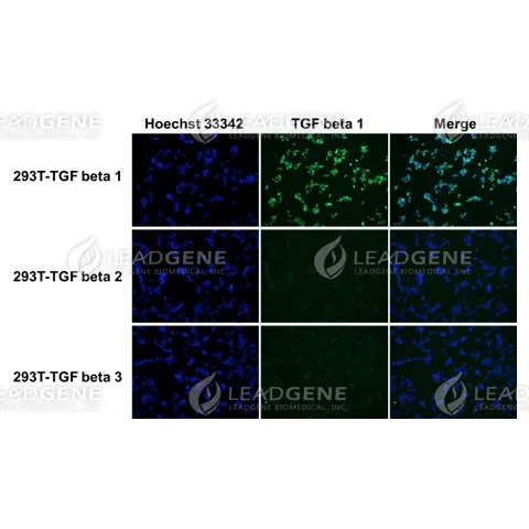 Anti-TGF Beta 1 Antibody [Clone 51-3]