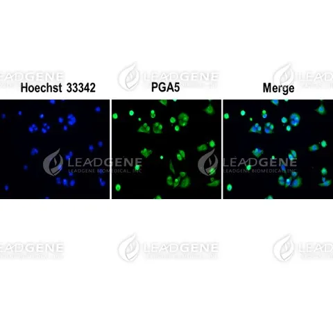Anti-PGA5 Antibody [Clone 85-5]
