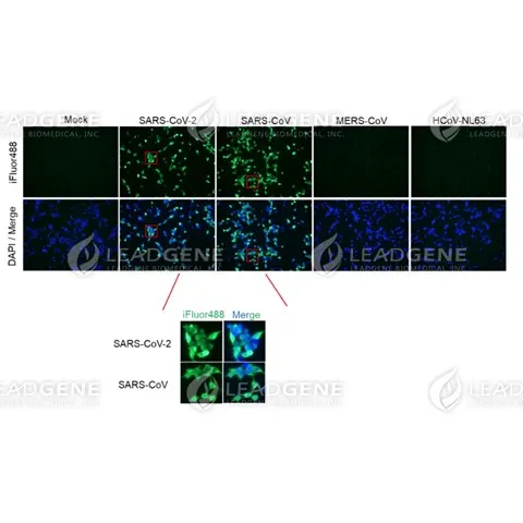 Anti-SARS-CoV & CoV-2 NP IgG Antibody