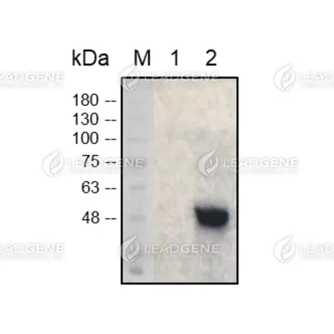 Western blotting analysis of Human anti-SARS-CoV &amp; CoV-2 NP antibody (IgG) (1:1000) Lane 1 : SARS-CoV-2 NP Lane 2 : SARS-CoV NP Lane 3 : MERS-CoV NP Lane 4 : HCoV-NL63 NP