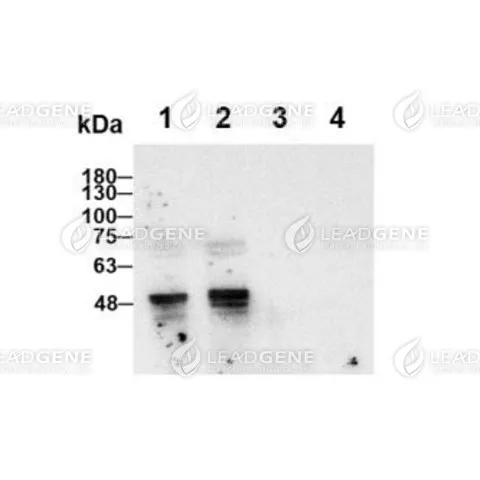 Western blotting analysis of Human anti-SARS-CoV &amp; CoV-2 NP antibody (IgG) (1:1000) Lane 1 : SARS CoV-2 NP Lane 2 : SARS CoV NP Lane 3 : MERS COV NP Lane 4 : HCoV-NL63 NP