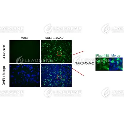 Anti-SARS-CoV & CoV-2 Spike IgM Antibody [Clone CR3022]
