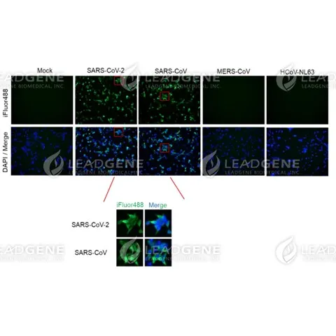 Anti-SARS-CoV-2 NP Antibody [Clone 102-7]