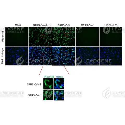 Anti-SARS-CoV-2 NP Antibody [Clone 109-5]