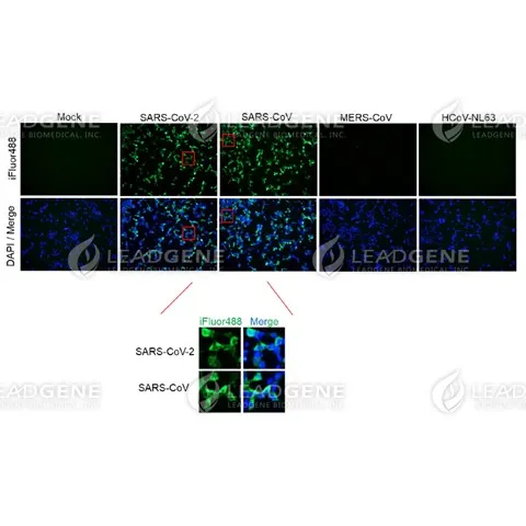 Anti-SARS-CoV-2 NP Antibody [Clone 37-3]