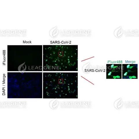 Anti-SARS-CoV-2 Spike Antibody [Clone LGSV201]