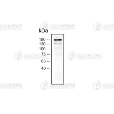 Anti-SARS-CoV-2 Spike Antibody [Clone LGSV201]