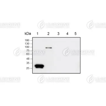 LDG0086YAWB01 Western blotting analysis of Mouse anti-SARS-CoV-2 Spike mAb (1:5000)Lane 1: SARS-CoV-2 S1-RBDLane 2: SARS-CoV-2 S1Lane 3: SARS-CoV S1-RBDLane 4: SARS-CoV S1Lane 5: MERS-CoV S1-RBD