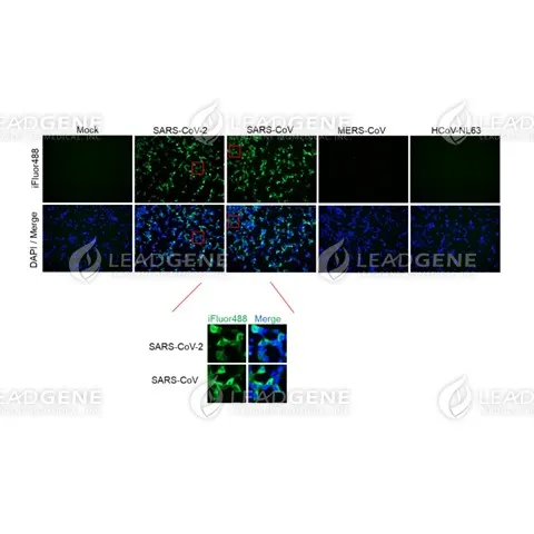Anti-SARS-CoV-2 NP Antibody [Clone 88]