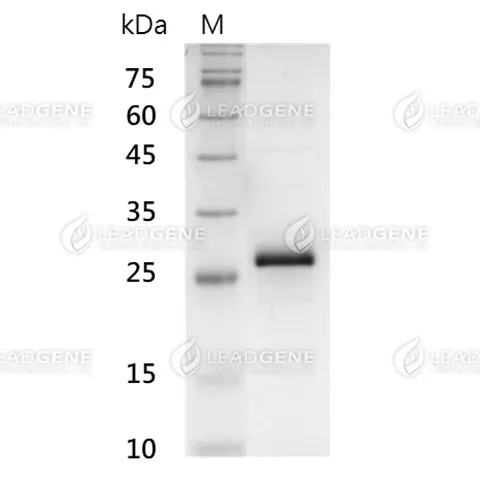 SDS-PAGE analysis of recombinant SUMO Protease (ULP1)