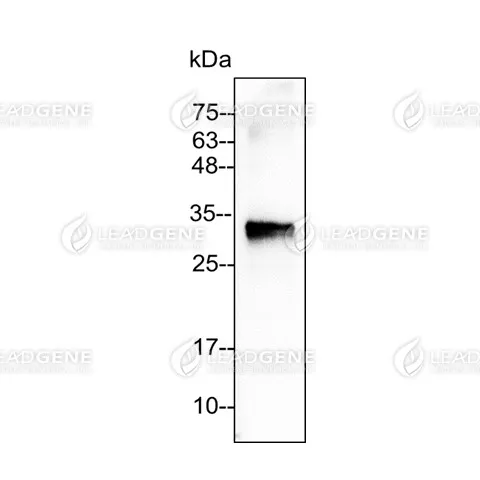 Anti-SUMO Tag Antibody [Clone 2-2]