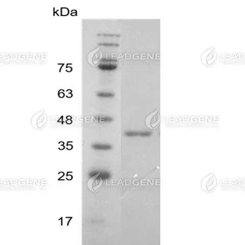 Human RAGE, His Tag, E. coli