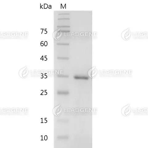 Human Annexin V, His Tag, E. coli