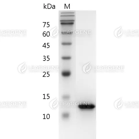 Human CD40L, His Tag, E. coli