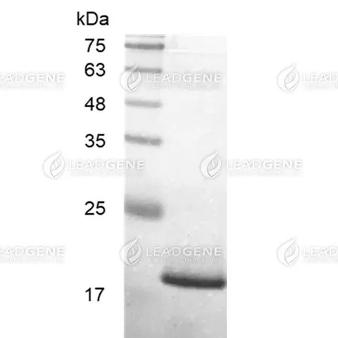 Human CD27L, His Tag, E. coli