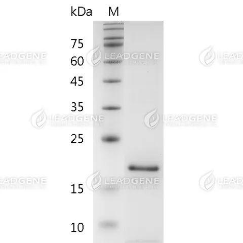 Human CD30L, His Tag, E. coli