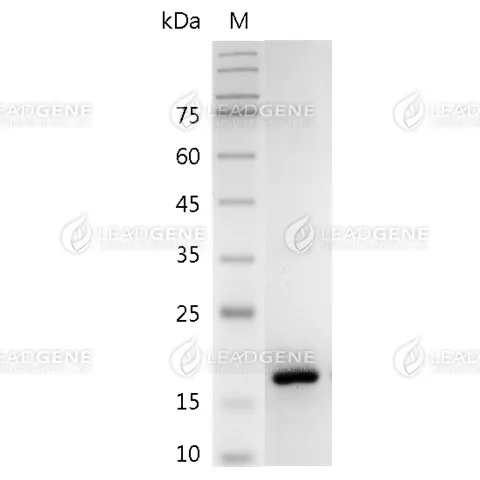 Mouse CD27L, His Tag, E. coli