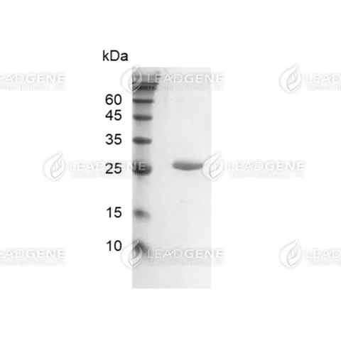 SDS-PAGE analysis of recombinant Endoglycosidase H