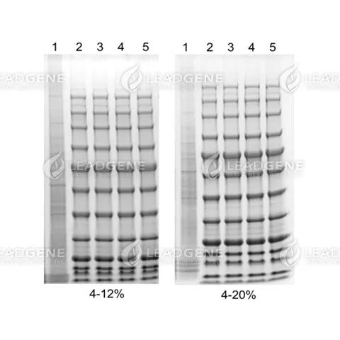 Leadgene® Precast Protein Gel electrophoresis Lane 1: Cell lysates; Lane 2-5: protein marker