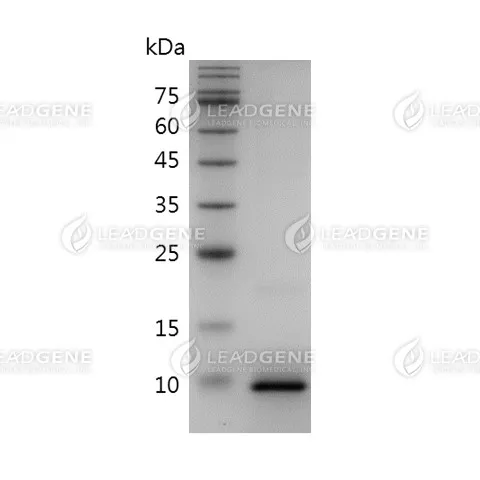 SDS-PAGE analysis of recombinant Human CCL3.