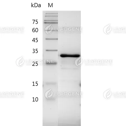 Human NRG1 Protein, Tag Free, E. coli