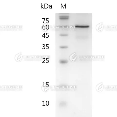 Human MTM1, His Tag, E. coli