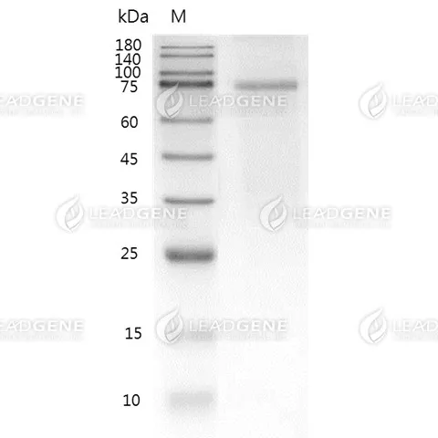 Human PROS1, His-SUMO Tag, E. coli