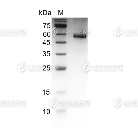 SDS-PAGE analysis of recombinant Human Noggin.