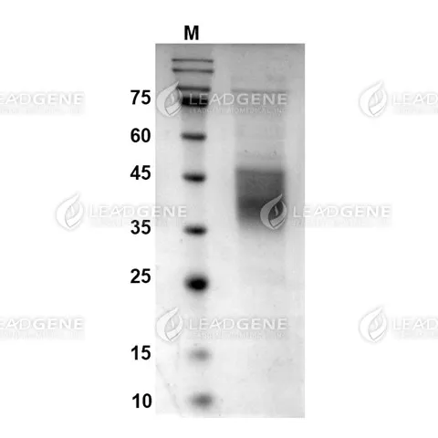 Canine PD-L1 Protein, His Tag, HEK293