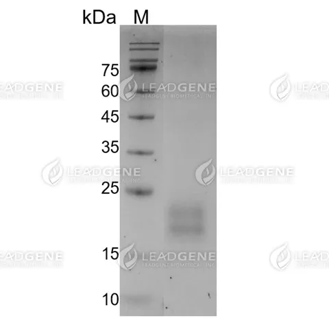 Canine CTLA-4 Protein, His Tag, HEK293