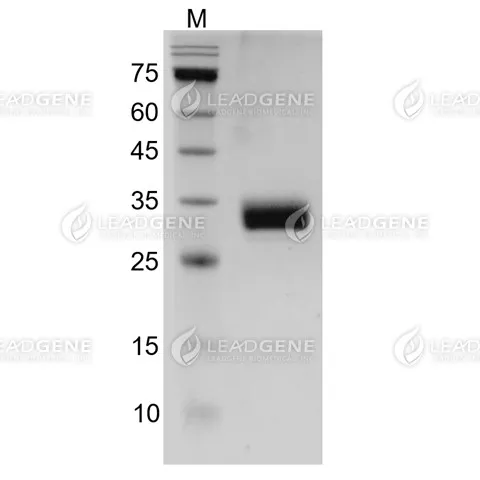 Human PD-L1, His Tag, HEK293