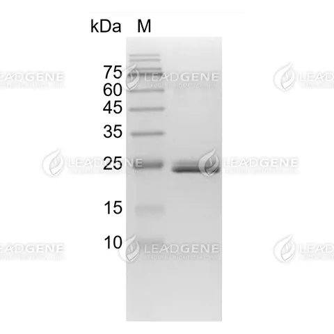 SDS-PAGE analysis of recombinant SUMO-Specific Protease 2 (SENP2).