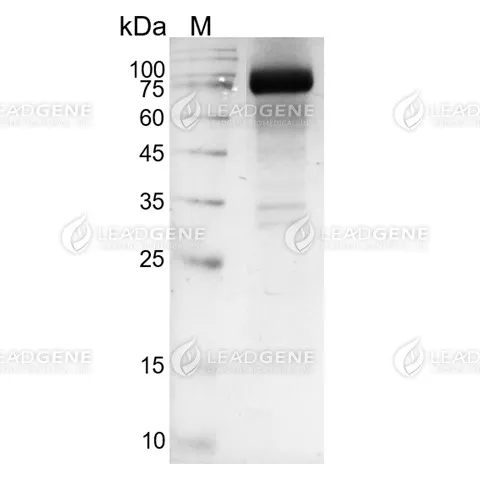 Human HGF, His Tag, HEK293