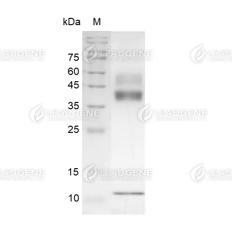 Human TGF beta 1, His Tag, HEK293