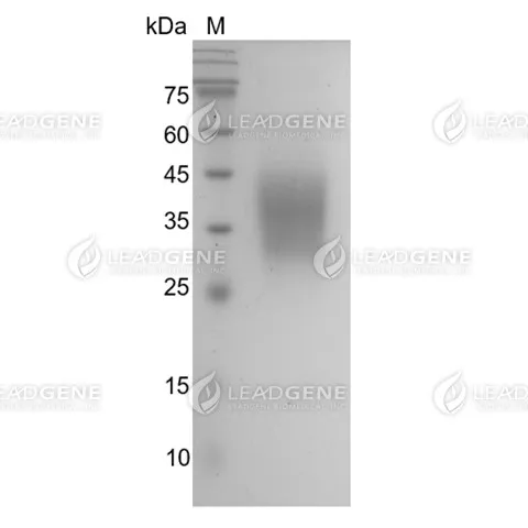 Human IL-18BP, His Tag, HEK293