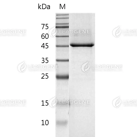 Mouse GFAP, His Tag, E. coli