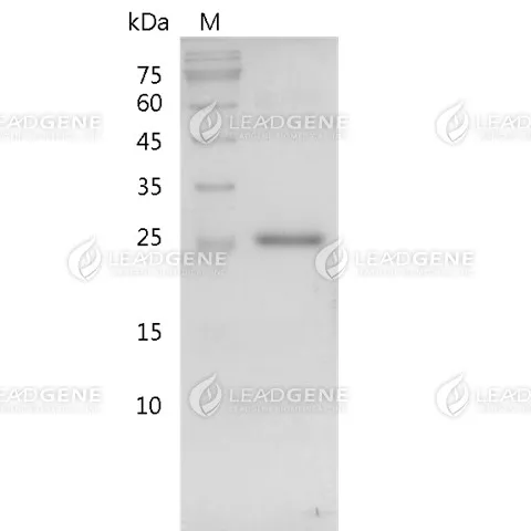 EGFP, His Tag, E. coli