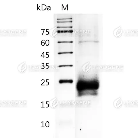 Mouse CTLA-4, His Tag, HEK293