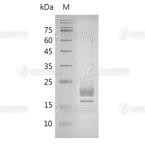 Human M-CSF, His Tag, HEK293