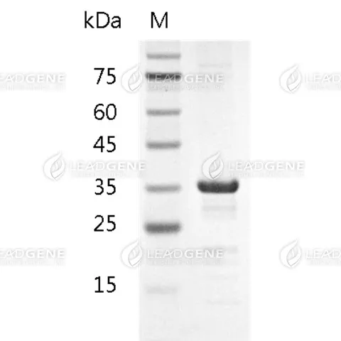 Mycoplasma pneumoniae P1 Protein, His tag, E. coli