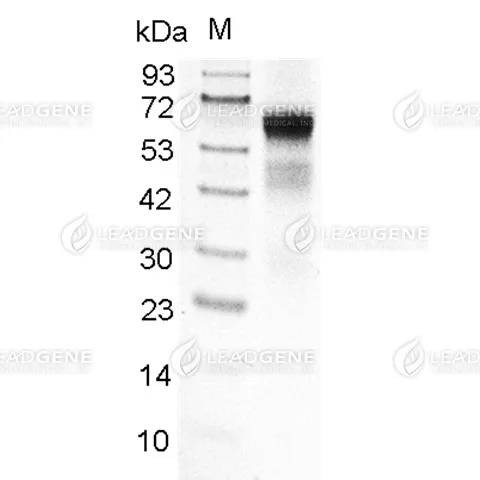 SDS-PAGE analysis of recombinant Human IL-6R.