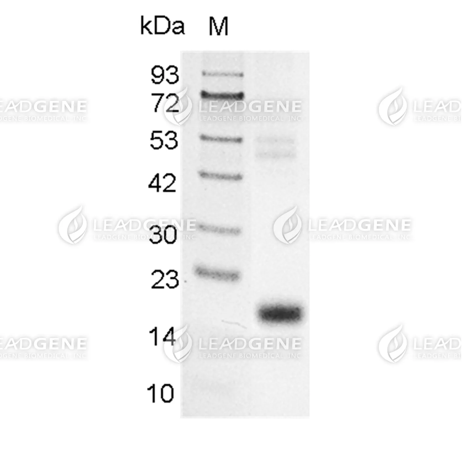 Human Factor X (Light Chain) Protein, His Tag, CHO