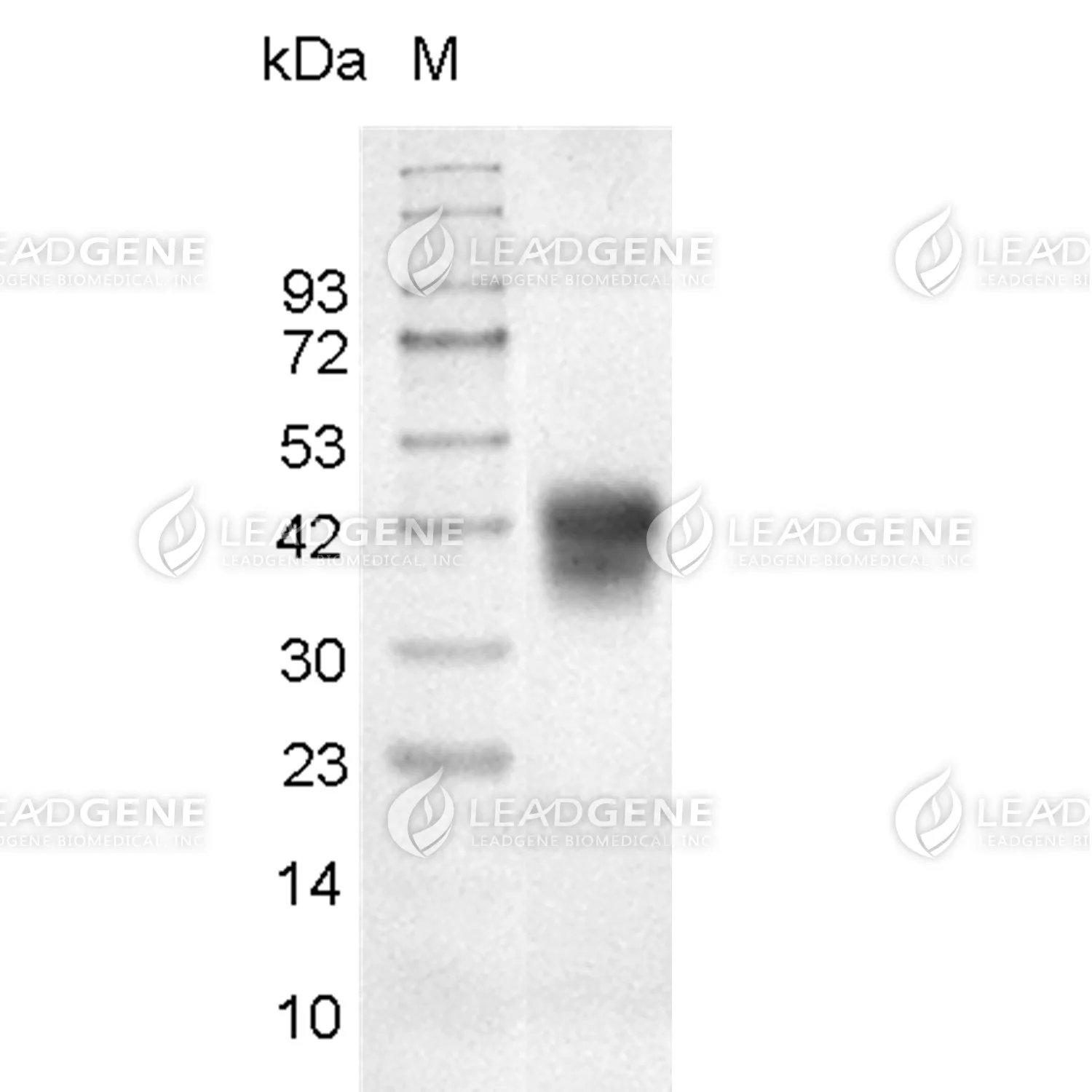 Human MSLN (296-580), His Tag, CHO