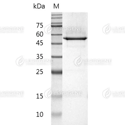 Mouse Vimentin, His Tag, E. coli