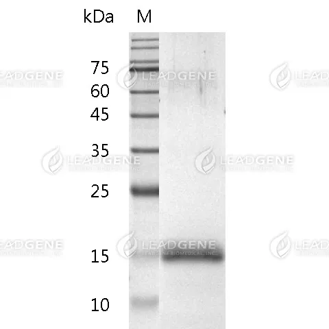 SDS-PAGE analysis of recombinant human DR5.