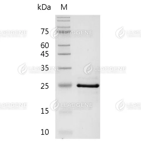 Mouse Glucocorticoid Receptor, His Tag, E. coli