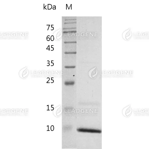 Mouse PSCA, His Tag, E. coli