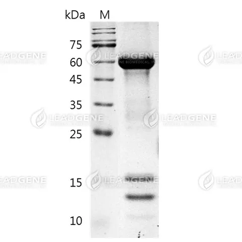 Human PCSK9, His Tag, CHO