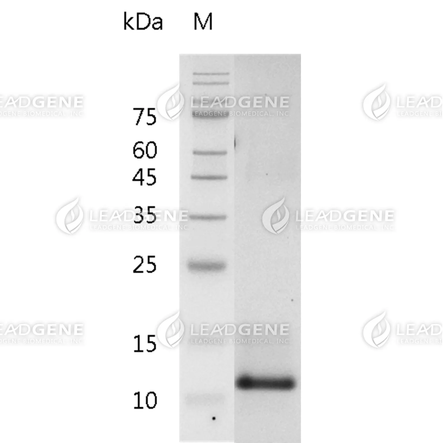 Human CGRP, His Tag, HEK293